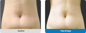 case05-1