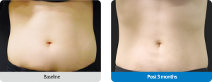 case06-1